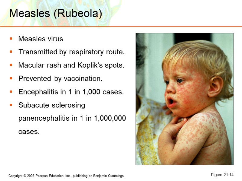 Measles (Rubeola) Measles virus Transmitted by respiratory route. Macular rash and Koplik's spots. Prevented